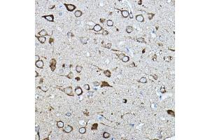 Immunohistochemistry of paraffin-embedded rat brain using KI Rabbit pAb (ABIN7271349) at dilution of 1:100 (40x lens).