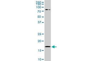 Western Blotting (WB) image for anti-Cofilin 1 (CFL1) (AA 1-167) antibody (ABIN598606) (Cofilin anticorps  (AA 1-167))