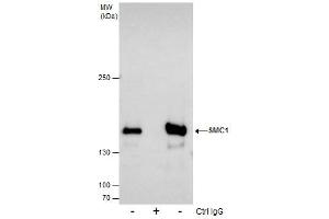 IP Image Immunoprecipitation of SMC1A protein from 293T whole cell extracts using 5 μg of SMC1A antibody [N1N2], N-term, Western blot analysis was performed using SMC1A antibody [N1N2], N-term, EasyBlot anti-Rabbit IgG  was used as a secondary reagent. (SMC1A anticorps  (N-Term))