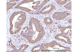IHC analysis of RPN1 using anti-RPN1 antibody (ABIN7600447). (RPN1 anticorps  (AA 196-495))
