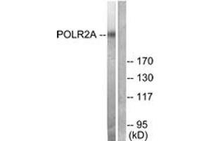 Western blot analysis of extracts from COS7 cells, treated with EGF 200ng/ml 30', using POLR2A (Ab-1619) Antibody. (POLR2A/RPB1 anticorps  (AA 1585-1634))
