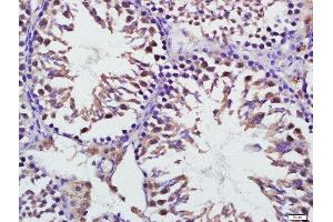 Paraformaldehyde-fixed, paraffin embedded mouse testis, Antigen retrieval by boiling in sodium citrate buffer (pH6) for 15min, Block endogenous peroxidase by 3% hydrogen peroxide for 30 minutes, Blocking buffer (normal goat serum) at 37°C for 20min, Antibody incubation with Mitofusin 1 Polyclonal Antibody, Unconjugated  at 1:400 overnight at 4°C, followed by a conjugated secondary for 20 minutes and DAB staining. (MFN1 anticorps  (AA 651-741))
