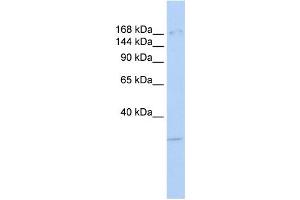 Western Blotting (WB) image for anti-Lysine (K)-Specific Demethylase 6A (KDM6A) antibody (ABIN2458408) (KDM6A anticorps)