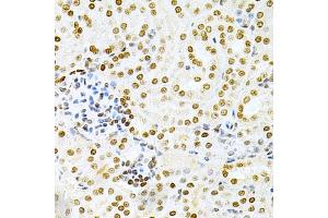 Immunohistochemistry of paraffin-embedded mouse kidney using DKC1 Antibody (ABIN3022640, ABIN3022641, ABIN1512829 and ABIN6218993) at dilution of 1:200 (40x lens). (DKC1 anticorps  (AA 245-514))