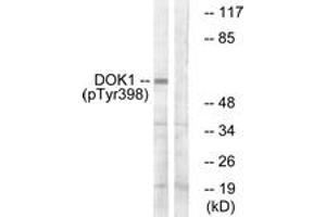 Western blot analysis of extracts from K562 cells treated with Starvation 24h, using p62 Dok (Phospho-Tyr398) Antibody. (DOK1 anticorps  (pTyr398))