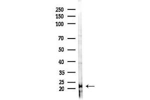 anti-Mitochondrial Ribosomal Protein S28 (MRPS28) (C-Term) antibody