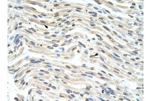 THOC3 antibody was used for immunohistochemistry at a concentration of 4-8 ug/ml to stain Myocardial cells (arrows) in Human Heart. (THO Complex 3 anticorps  (Middle Region))