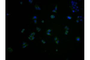 Immunofluorescence staining of Hela cells with ABIN7148898 at 1:100, counter-stained with DAPI. (CDK6 anticorps  (AA 102-326))