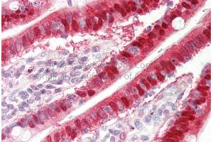 Rabbit Anti-SULT1A1 antibody  Formalin Fixed Paraffin Embedded Tissue: Human Adult Small intestine  Observed Staining: Cytoplasm in hepatocytes Primary Antibody Concentration: 1:600 Secondary Antibody: Donkey anti-Rabbit-Cy3 Secondary Antibody Concentration: 1:200 Magnification: 20X Exposure Time: 0.