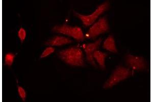 ABIN6272283 staining HeLa by IF/ICC. (CYB561D1 anticorps  (C-Term))