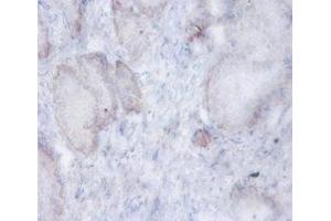 Immunohistochemistry of paraffin-embedded human prostate tissue using ABIN7143582 at dilution of 1:100 (AFG3L2 anticorps  (AA 550-759))