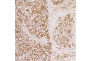 Immunohistochemistry (IHC) image for anti-Actin-Related Protein 2 (ACTR2) (AA 25-75) antibody (ABIN7453417)