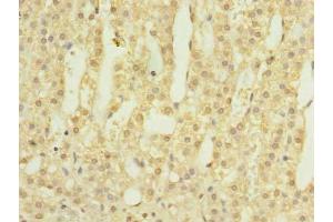 Immunohistochemistry of paraffin-embedded human adrenal gland tissue using ABIN7145628 at dilution of 1:100 (LOH12CR1 anticorps  (AA 1-196))