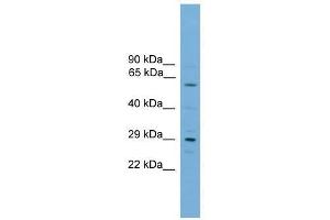 Western Blot showing RPAIN antibody used at a concentration of 1-2 ug/ml to detect its target protein. (RPAIN anticorps  (C-Term))