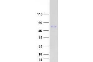 Validation with Western Blot
