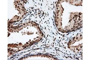 Immunohistochemical staining of paraffin-embedded liver tissue using anti-APP mouse monoclonal antibody. (APP anticorps)