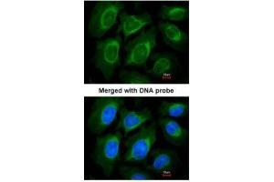 ICC/IF Image Immunofluorescence analysis of paraformaldehyde-fixed HeLa, using CCN3 , antibody at 1:200 dilution. (NOV anticorps  (Center))