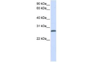 TMEM51 antibody used at 1 ug/ml to detect target protein. (TMEM51 anticorps  (N-Term))