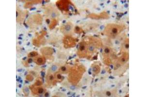 Used in DAB staining on fromalin fixed paraffin-embedded Liver tissue (IGF1 anticorps  (AA 48-118))