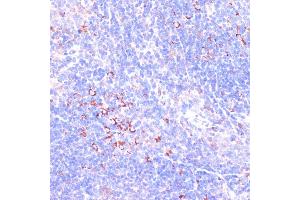 Immunohistochemistry of paraffin-embedded mouse spleen using Zyxinin antibody (ABIN3023008, ABIN3023009, ABIN3023010 and ABIN6219343) at dilution of 1:100 (40x lens). (ZYX anticorps  (AA 1-300))