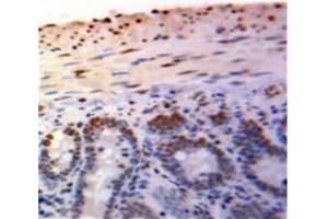 Used in DAB staining on fromalin fixed paraffin-embedded Bowels tissue (PML anticorps  (AA 59-239))