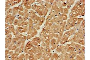 Immunohistochemistry of paraffin-embedded human heart tissue using ABIN7168941 at dilution of 1:100