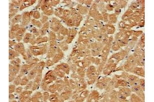 Immunohistochemistry of paraffin-embedded human heart tissue using ABIN7168941 at dilution of 1:100 (SRR anticorps  (AA 1-340))