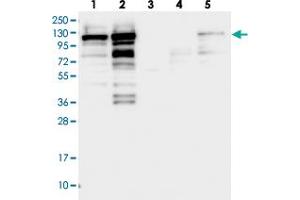 Western blot analysis of Lane 1: RT-4, Lane 2: U-251 MG, Lane 3: Human Plasma, Lane 4: Liver, Lane 5: Tonsil with SH3PXD2B polyclonal antibody . (SH3PXD2B anticorps)