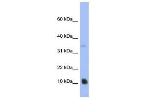MGC70863 antibody used at 1 ug/ml to detect target protein. (MGC70863 anticorps  (N-Term))