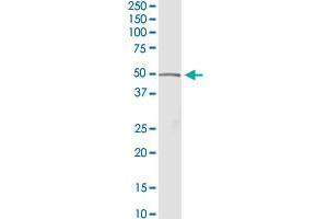 ACADM MaxPab rabbit polyclonal antibody. (Medium-Chain Specific Acyl-CoA Dehydrogenase, Mitochondrial (MCAD) (AA 1-421) anticorps)