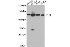Western blot analysis of extracts of various cell lines, using PHKB antibody.