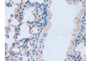 Detection of LCN5 in Mouse Lung Tissue using Polyclonal Antibody to Lipocalin 5 (LCN5)
