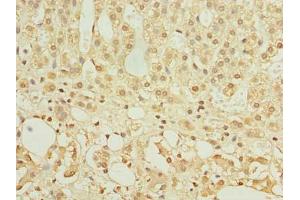 Immunohistochemistry of paraffin-embedded human adrenal gland tissue using ABIN7154963 at dilution of 1:100 (HEMK1 anticorps  (AA 1-338))