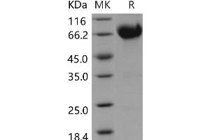 Western Blotting (WB) image for Interleukin 10 Receptor, beta (IL10RB) protein (Fc Tag) (ABIN7196362)