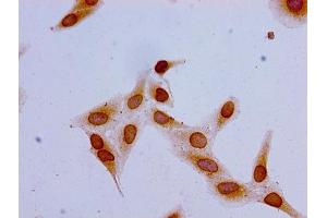 Immunocytochemistry analysis of Hela cells using ABIN7139162 at dilution of 1:100