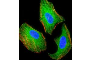 Fluorescent image of Hela cell stained with TSC2 Antibody (ABIN1539797 and ABIN2843773)/SG110509.