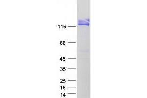 Validation with Western Blot