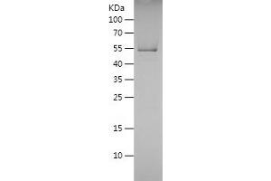 Western Blotting (WB) image for Protein tyrosine Phosphatase, Receptor Type, C (PTPRC) (AA 915-1306) protein (His tag) (ABIN7124683)