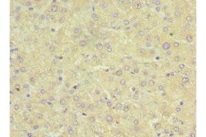 Immunohistochemistry of paraffin-embedded human liver tissue using ABIN7170334 at dilution of 1:100 (SRI anticorps  (AA 1-198))