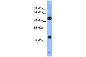WB Suggested Anti-PSMD1 Antibody Titration: 0. (PSMD1 anticorps  (N-Term))