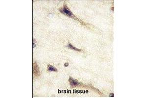Paraformaldehyde-fixed, paraffin embedded Human Brain tissue, Antigen retrieval by boiling in sodium citrate buffer (pH6.