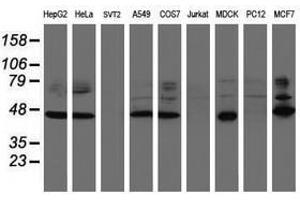 Image no. 1 for anti-serpin Peptidase Inhibitor, Clade B (Ovalbumin), Member 1 (SERPINB1) (AA 77-306) antibody (ABIN1491673) (SERPINB1 anticorps  (AA 77-306))