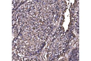 IHC analysis of EXOSC3 using anti-EXOSC3 antibody (ABIN7602216).