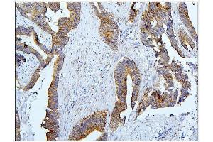 IHC analysis of BubR1/BUB1B using anti-BubR1/BUB1B antibody (ABIN7600962). (BUB1B anticorps  (AA 26-448))