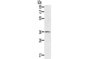 Western Blotting (WB) image for anti-Ring Finger Protein 144B (RNF144B) antibody (ABIN2430277)