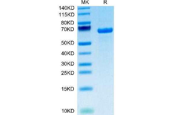 DLL1 Protein (AA 18-540) (His tag)