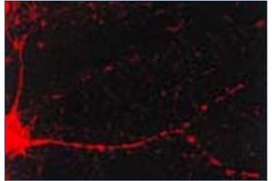 Immunofluorescence (IF) image for anti-Calcium/calmodulin-Dependent Protein Kinase II alpha (CAMK2A) antibody (ABIN492419) (CAMK2A anticorps)