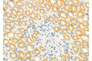 ABIN6262020 and ABIN6279472 at 1/100 staining Rat kidney tissue by IHC-P.