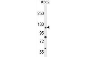 ANR52 Antibody (N-term) western blot analysis in K562 cell line lysates (35µg/lane). (ANKRD52 anticorps  (N-Term))