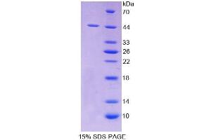 SDS-PAGE analysis of Human SCARA5 Protein.